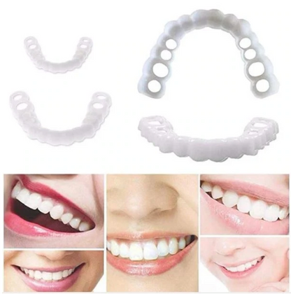 HappySmile™ — Reusable Veneer Set (Top & Bottom)